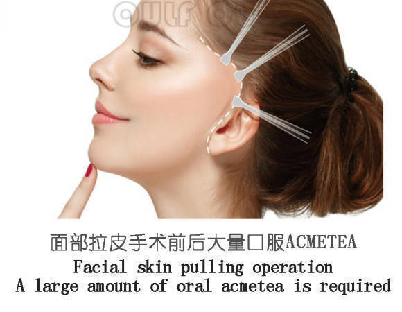 拉皮手术风险大吗、有风险<strong></p>
<p>货币基金有风险吗</strong>！妈妈说拔牙都有风险
