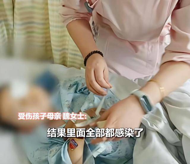 江西一5岁男孩在幼儿园被戳伤致左眼失明<strong></p>
<p>以太坊价格走势</strong>，家长称老师用猪油涂抹试图消肿