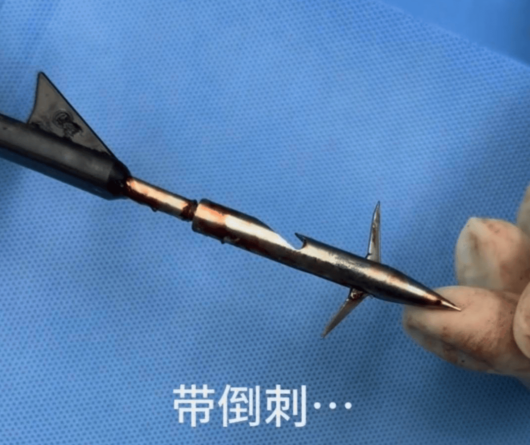 教育局回应“一教师用弓箭射杀小狗”:不实<strong></p>
<p>以太坊价格走势</strong>,小狗进学校前就被射伤