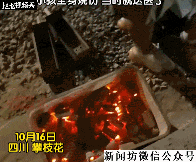 孩子烧烤店掉进炭火灰！最新：85%烧伤性命垂危<strong></p>
<p>eth算力</strong>，双手需截肢