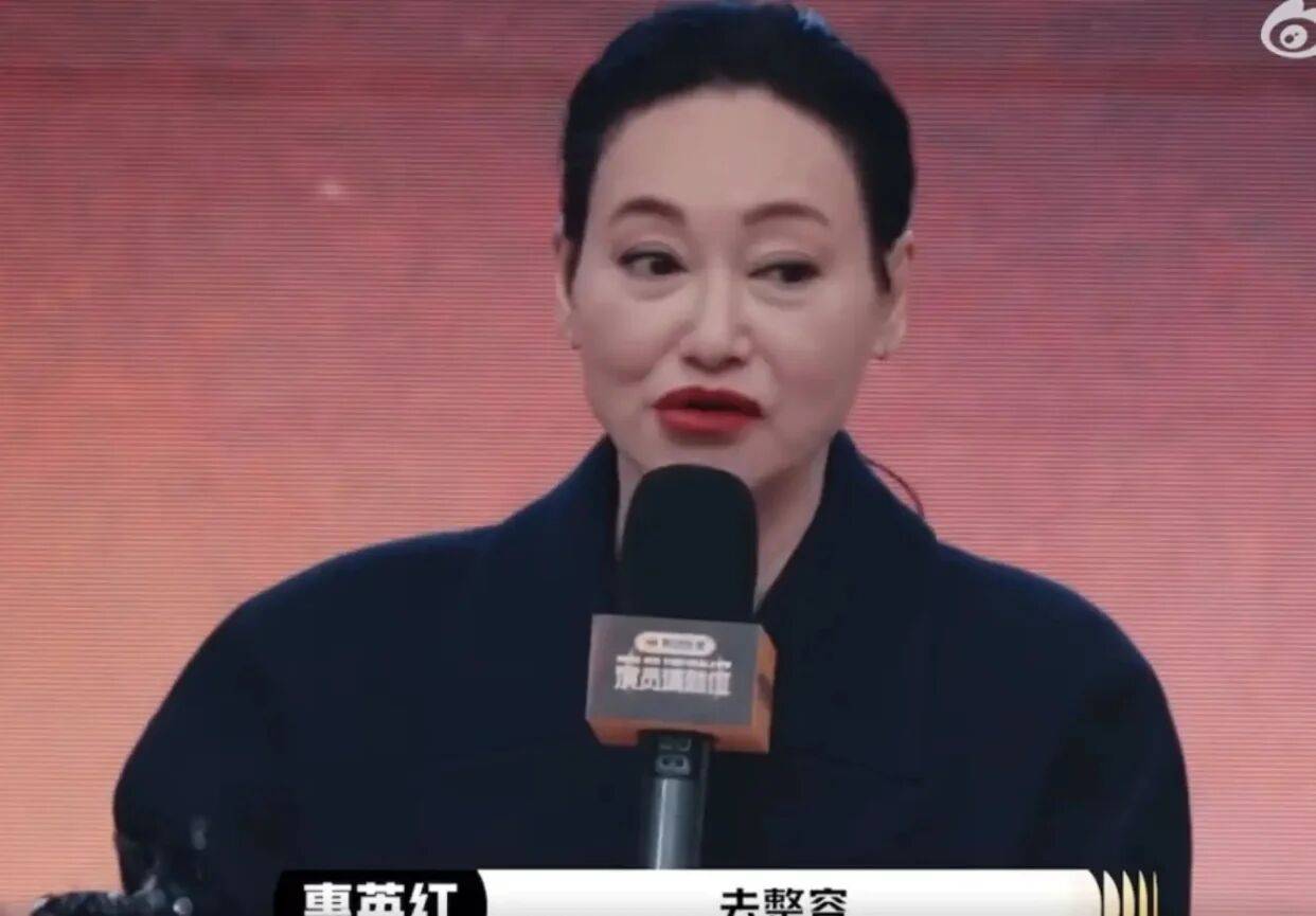 考古|惠英红自曝拿奖后谈百倍涨薪！拍打戏至残疾阑尾手术后7天复工<strong></p>
<p>比特币最新价格</strong>，她的人生是拼出来的